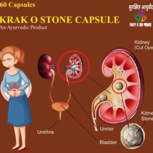 krack o stone