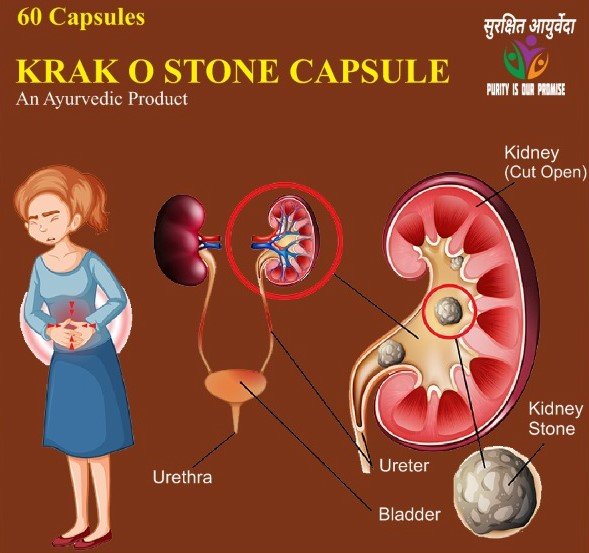 krack o stone